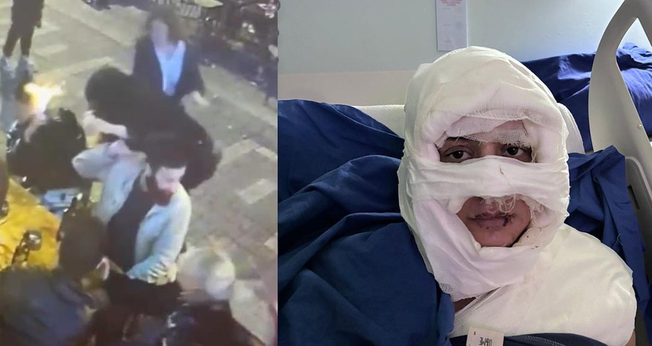 Bir kadının üzerine yanıcı madde döktü, ateşe verdi! Cani sanığa 4 yıl hapis istendi